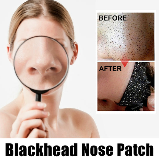 GDBadais Black Pig Nose Patch, Bamboo Charcoal Remove Blackhead Acne Tear Nose Mask Patch