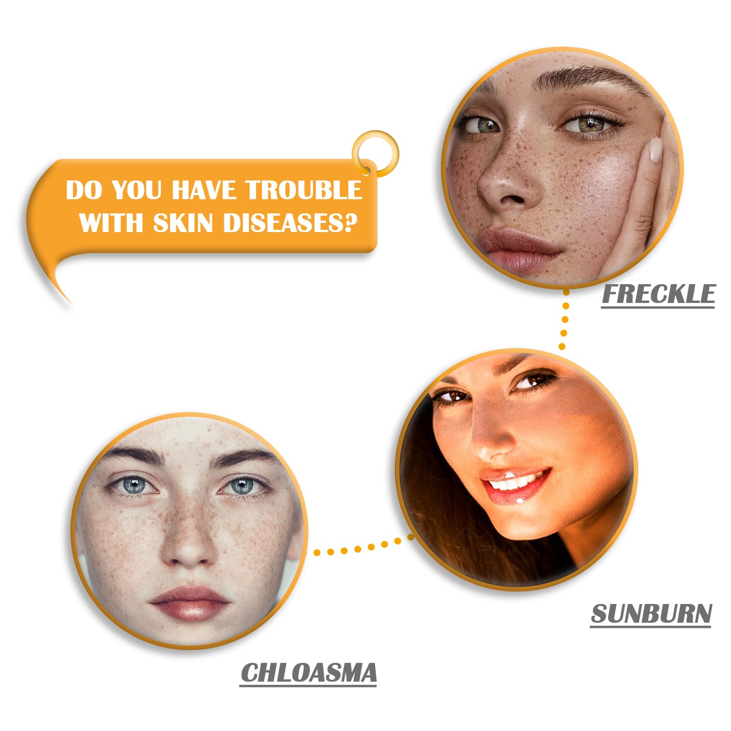 GDBadais Kojic Acid Soap Cleanser Cleansing Soap Dilute Cleansing Cleanser Pore-Clearing Exfoliating Skincare Soap