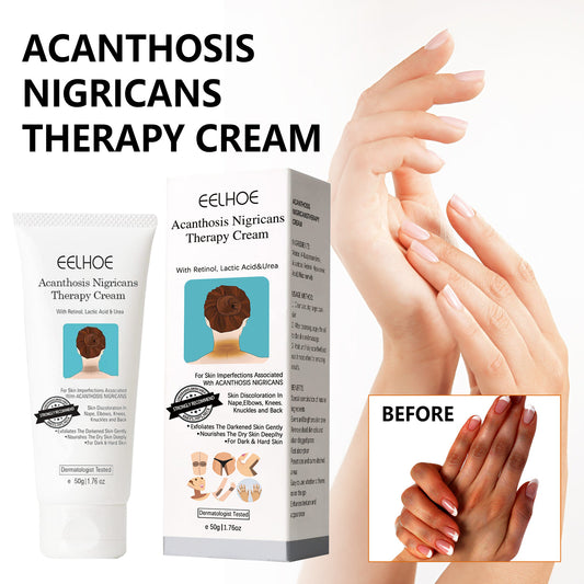GDBadais Black Acanthoderm Repair Cream Repair Underarm Arm Knee Joint Black Moisturizing Whitening Body Care Cream