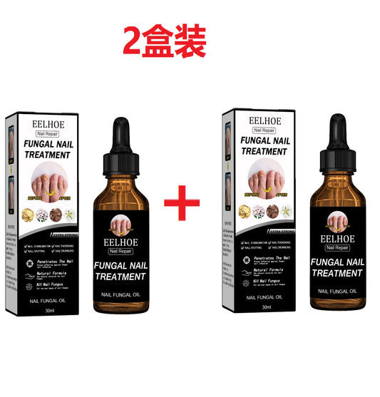 GDBadais Nail Repair Solution Thickening Brightening Nails Removing Gray Nails Dead Skin Repair Nourishing Nail Care Solution