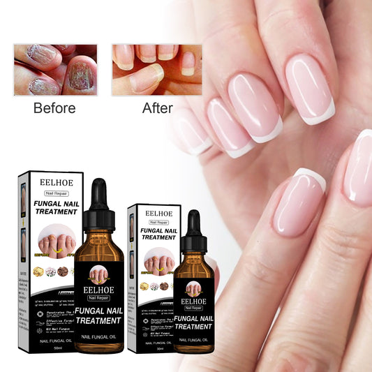 GDBadais Nail Repair Solution Thickening And Brightening Nails Removing Gray Nail Repair Nourishing Nail Care Solution