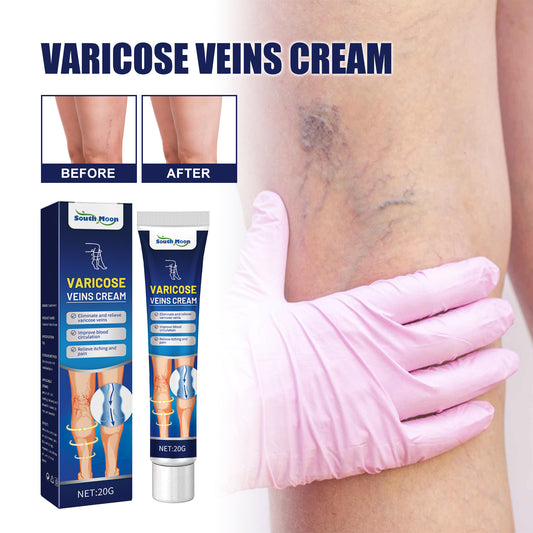 GDBadais Vein Massage Varicose Cream Repair Earthworm Legs To Relieve Leg Blood Vessel Bulge And Varicoidea