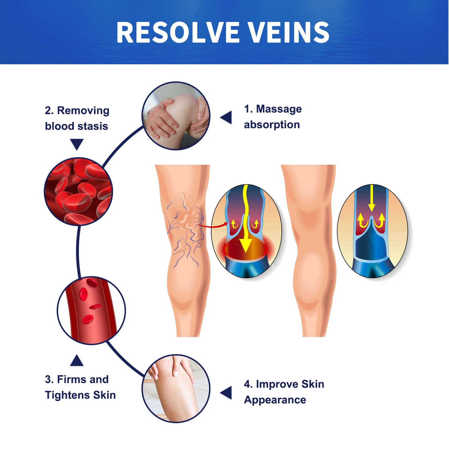 GDBadais Vein Massage Varicose Cream Repair Earthworm Legs To Relieve Leg Blood Vessel Bulge And Varicoidea