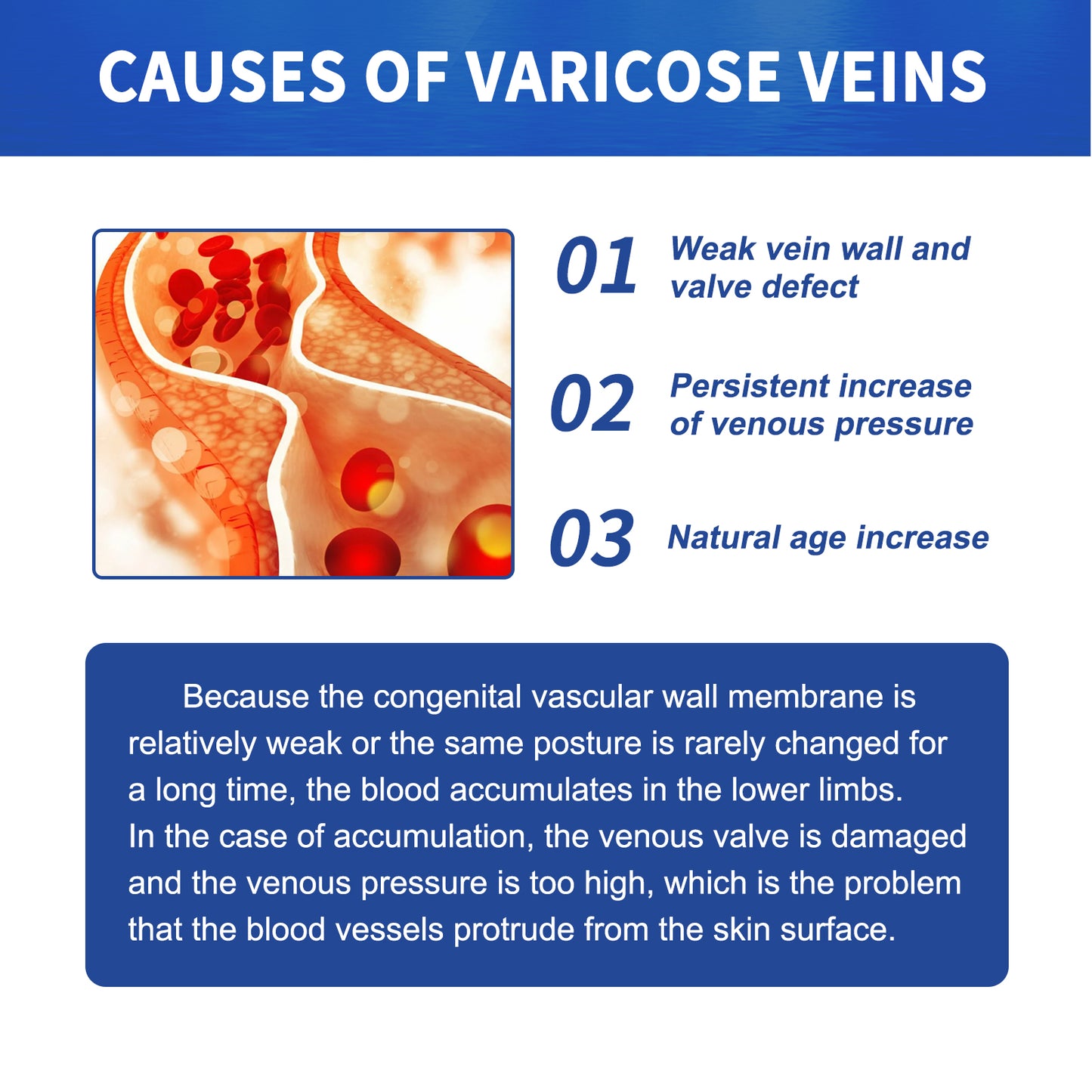 GDBadais Vein Massage Varicose Cream Repair Earthworm Legs To Relieve Leg Blood Vessel Bulge And Varicoidea