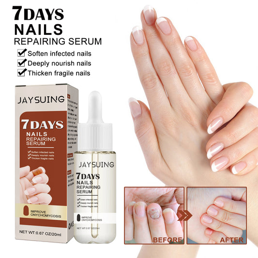 GDBadais 7 Day Nail Care Essence Grey Nail, Hand, Foot And Nail Nourishing Cleansing Essence