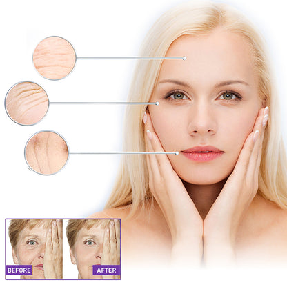 GDBadais Facial Wrinkle Patch, Droop Decree Line Lift Facial Skin Tightens Mouth Line Cheek Patch