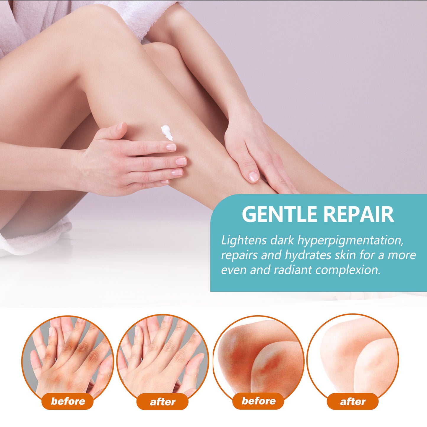 GDBadais Black Acanthoderm Repair Cream Repair Underarm Arm Knee Joint Black Moisturizing Whitening Body Care Cream
