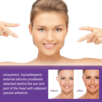 GDBadais Cosmetic Ear Correctors, Ear Display Small Support Corrects Flapper Ear Pinna Shape Waterproof Ear Stickers
