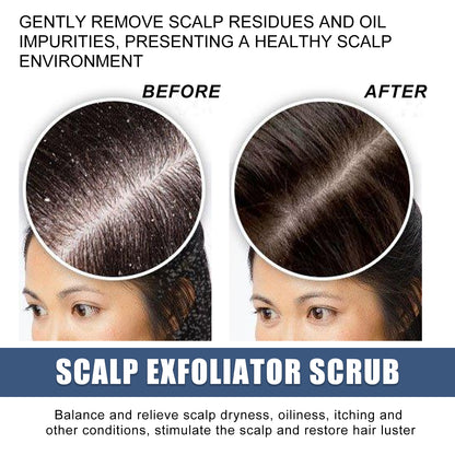 GDBadais Scalp Exfoliating Scrub Moisturizes Dry Hair And Scalp Cleansing Treatment Refreshing Scrub