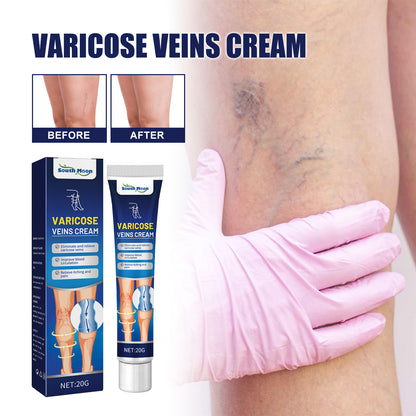 GDBadais Vein Massage Varicose Cream Repair Earthworm Legs To Relieve Leg Blood Vessel Bulge And Varicoidea
